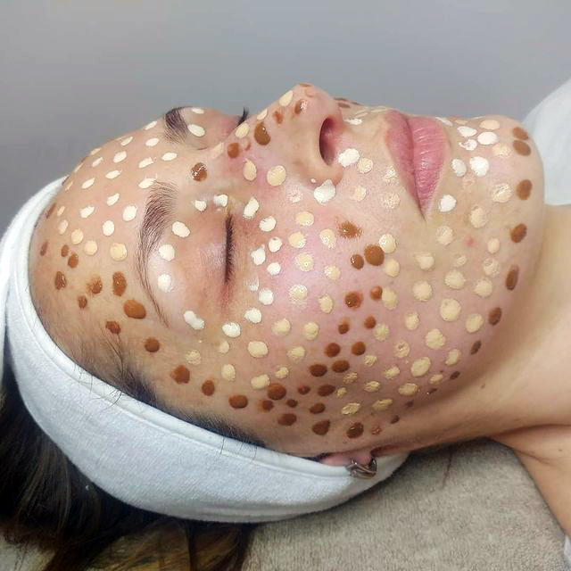 Nega lica i vitaminski tretmani kože - Gloss studio